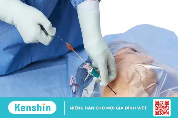 Những nguy cơ tiềm ẩn khi tự truyền dịch tại nhà 4