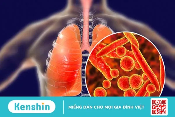 Những nguyên nhân gây vô sinh thứ phát ở nam giới 1