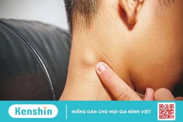 Nguyên nhân gây ra hiện tượng nổi hạch ở vành tai là gì? Biện pháp phòng ngừa 1