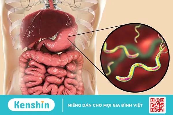 Nóng bụng cảnh báo bệnh gì? Cách điều trị nóng bụng 3