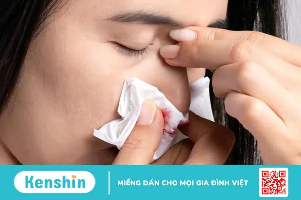 Nước mũi có máu: cảnh báo từ chuyên gia! 2