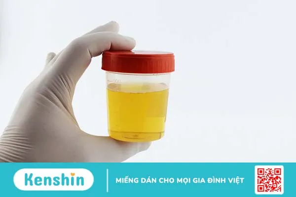 Nước tiểu nóng cảnh báo bệnh gì? Nguyên nhân do đâu 2