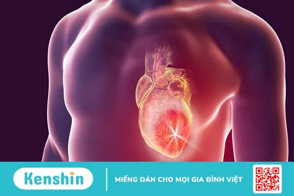 Phác đồ điều trị nhồi máu cơ tim như thế nào? Biện pháp phòng bệnh hiệu quả 3