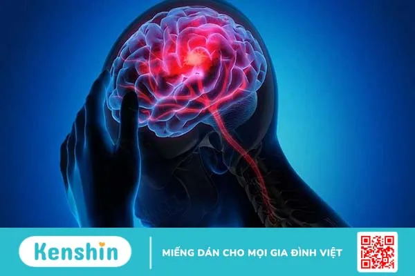 Phản xạ có điều kiện là gì? Phân loại các dạng phản xạ có điều kiện 1