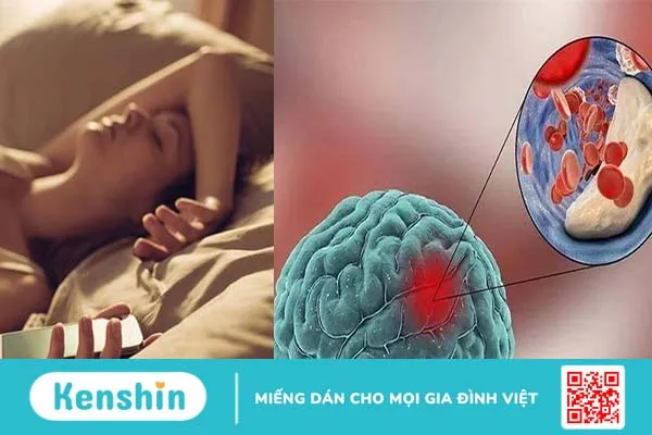 Phẫu thuật dị dạng mạch máu não và cách chăm sóc sau phẫu thuật 2