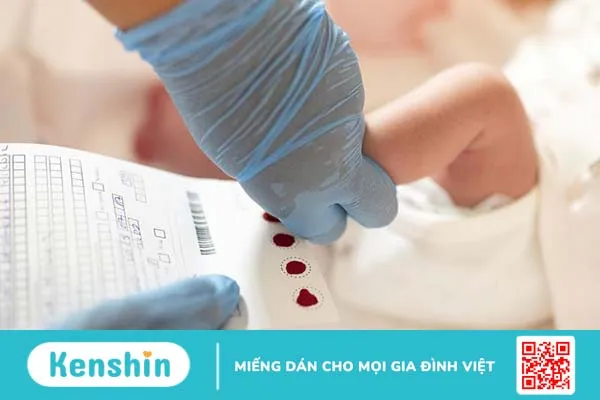 Phenylketone niệu (PKU): Nguyên nhân, triệu chứng và điều trị 4