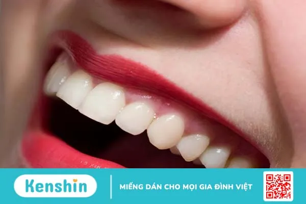 Phục hình răng là gì? Có những phương pháp phục hình răng nào?-2