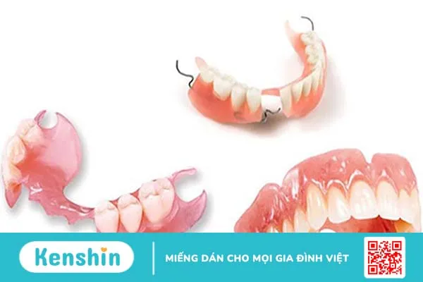 Phục hình răng là gì? Có những phương pháp phục hình răng nào?-3