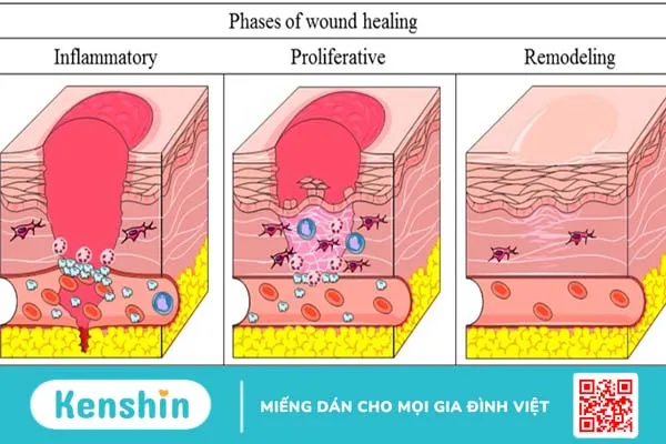 Phục hồi da nhờ yếu tố tăng trưởng và các vấn đề có liên quan 1