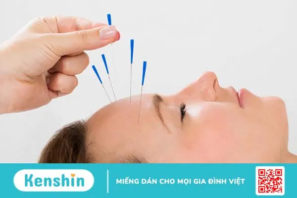 Phương pháp chữa méo miệng liệt mặt