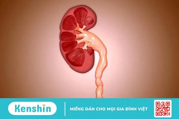 Phương pháp điều trị hẹp niệu quản hiệu quả 2