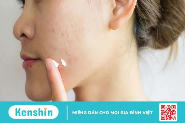 Cách sử dụng Tretinoin trị sẹo rỗ 0