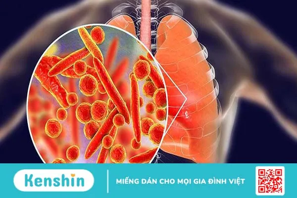 Bệnh gây ra bởi vi khuẩn Mycoplasma và phương pháp xét nghiệm Mycoplasma 1