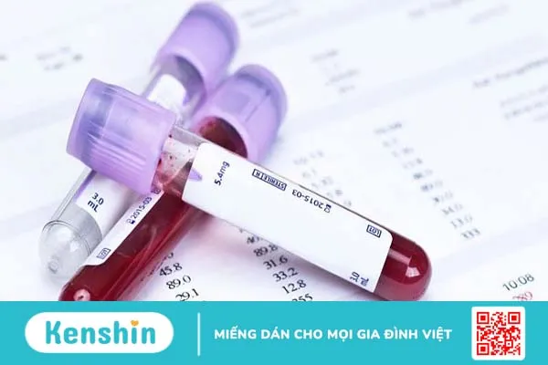 Bệnh gây ra bởi vi khuẩn Mycoplasma và phương pháp xét nghiệm Mycoplasma 3