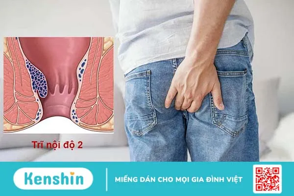 Quy trình khám trĩ ở bệnh viện Bình Dân 3