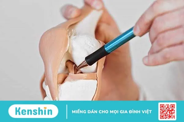 Rách sụn chêm bao lâu thì khỏi? Cần chú ý điều gì khi thực hiện các bài tập phục hồi chức năng? 2