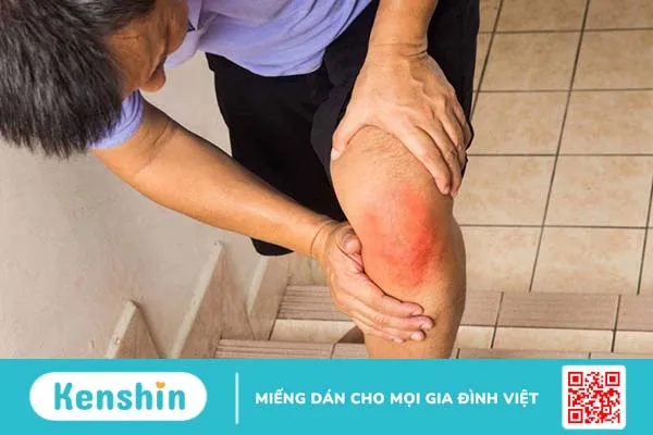 Rách sụn chêm nên ăn gì? Lợi ích của chế độ dinh dưỡng cho các bệnh về xương khớp 1