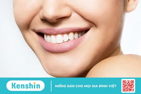 Răng lồi xỉ là gì, nguyên nhân và cách điều trị 3