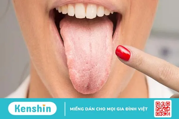 Rát lưỡi: Nguyên nhân và cách xử lý 1