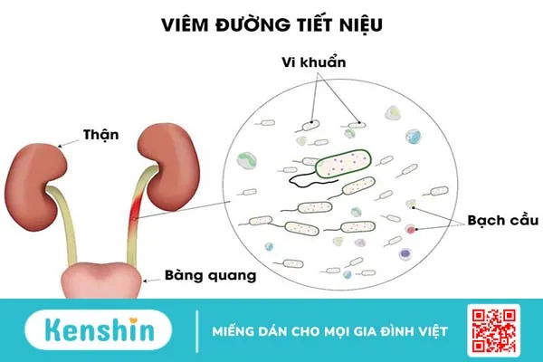 Rau tầm bóp là gì? Có bị ngộ độc rau tầm bóp không? 2