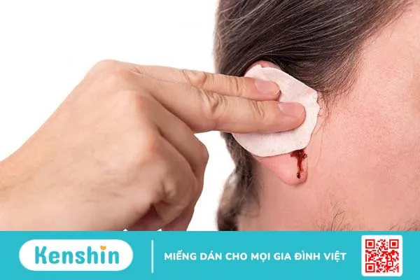 Ráy tai bị chảy máu có sao không? 3