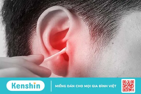 Ráy tai là gì, màu sắc ráy tai biểu thị bệnh lý gì? 3