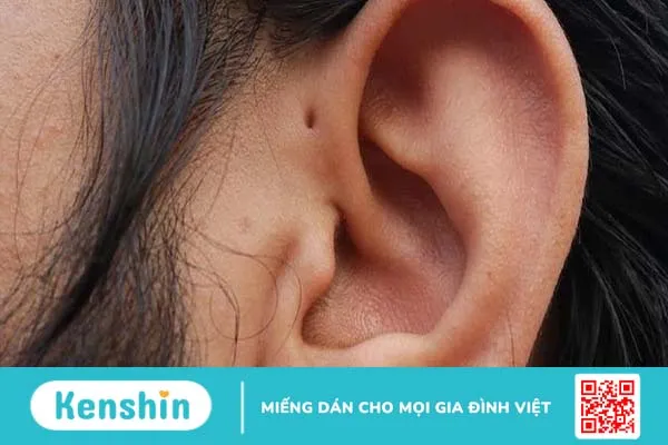 Rò luân nhĩ ở người lớn nguy hiểm không? Cách chữa như thế nào? 1