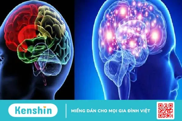 Rối loạn chức năng vỏ não - Nguyên nhân gây suy nhược thần kinh 1