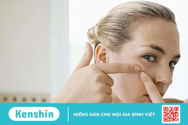 Rối loạn kinh nguyệt gây mụn: Nguyên nhân và giải pháp điều trị bệnh 1