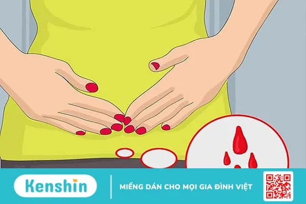 Phương pháp nạo hút thai có thể gây xuất huyết tử cung và buồng trứng