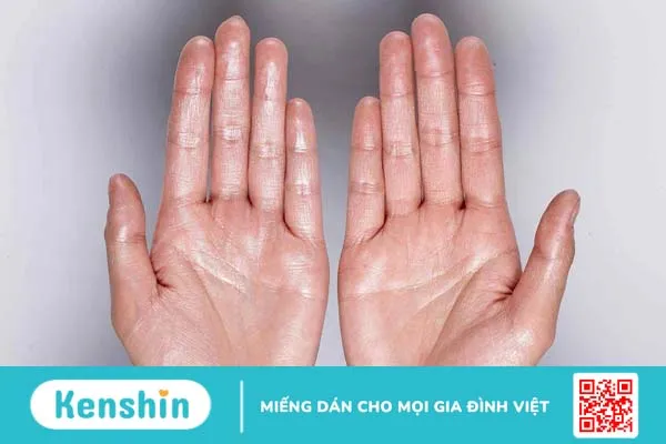 Run do rối loạn thần kinh thực vật là gì? 3