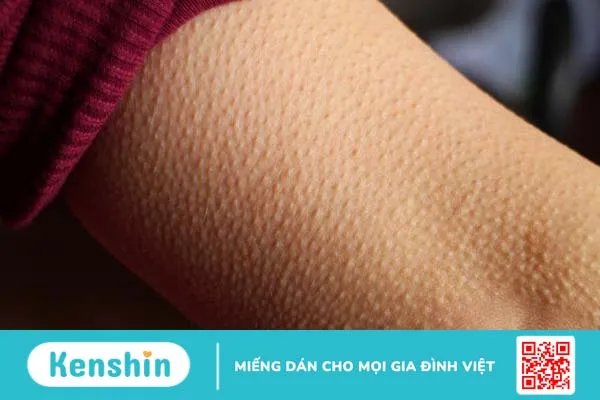 Rùng mình là gì? Làm thế nào để hết rùng mình? 1