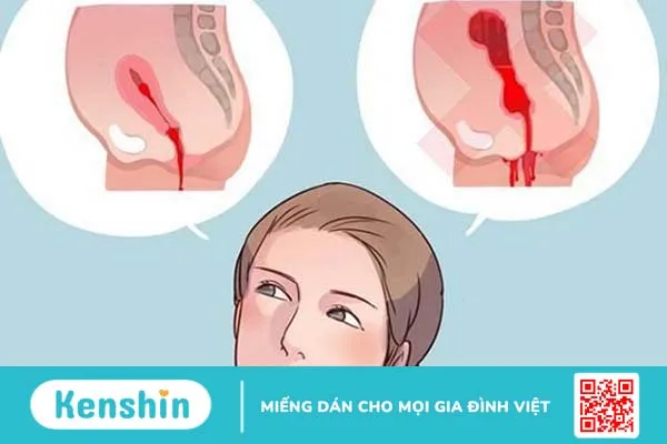 Sản dịch và kinh non sau sinh có giống nhau không? Cách phân biệt thế nào? 1