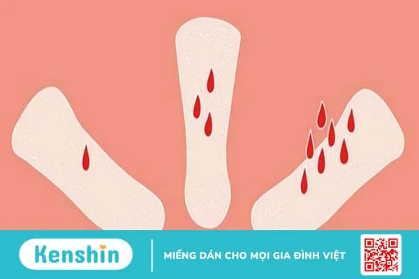 Sản dịch và kinh non sau sinh có giống nhau không? Cách phân biệt thế nào? 2