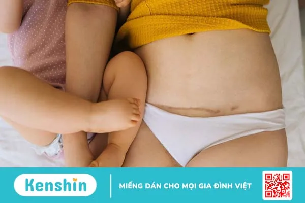 Sau sinh mổ bao lâu thì có kinh nguyệt lại? 4