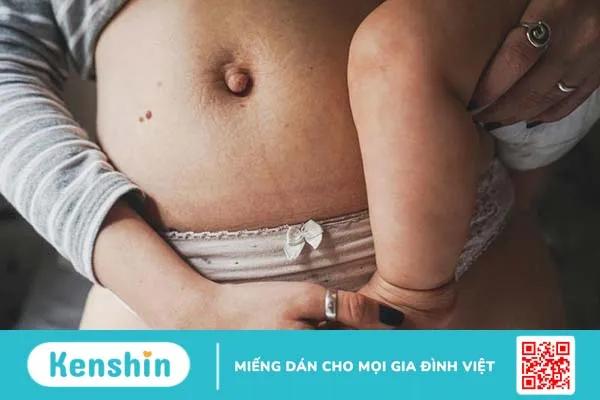 Bạn hỏi bác sĩ sản khoa trả lời: Sau sinh thường bao lâu thì gen bụng 1