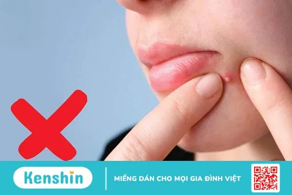 Sẹo lồi sau mụn: Nguyên nhân và cách điều trị 2