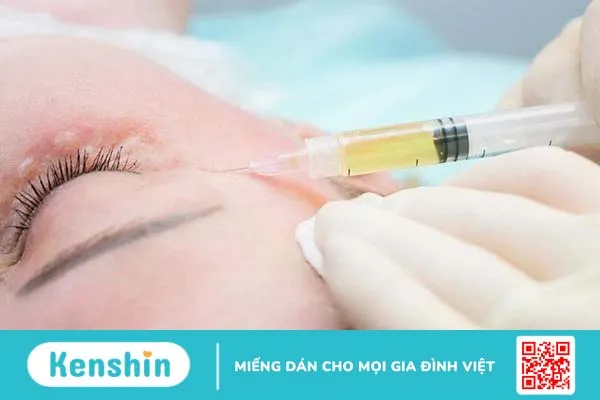 Sẹo lồi sau mụn: Nguyên nhân và cách điều trị 4