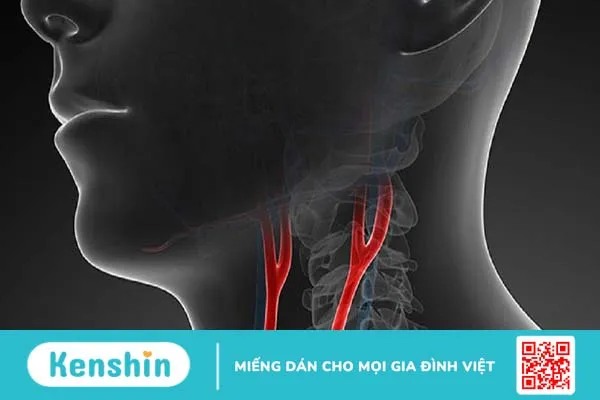 Siêu âm động mạch cảnh 2