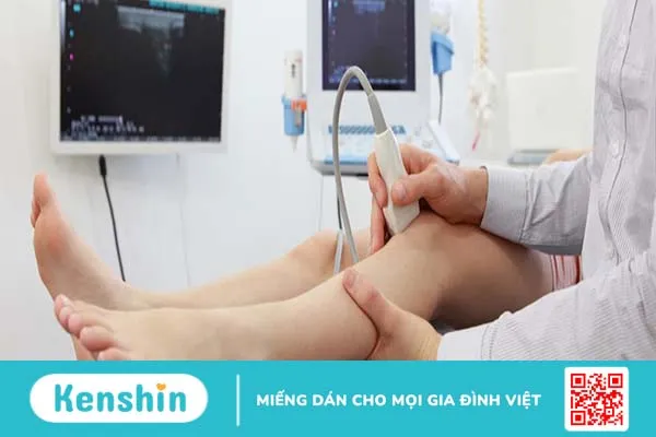 Siêu âm tĩnh mạch chi dưới, khi nào nên thực hiện? 4