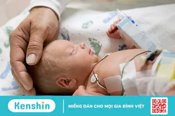 Sinh non 30 tuần có nuôi được không? Những lưu ý khi chăm sóc trẻ tại nhà 1