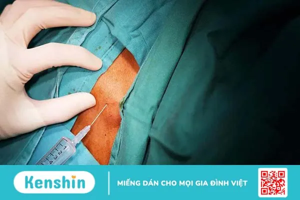 Sinh thiết là gì? Quá trình sinh thiết diễn ra như thế nào? 4