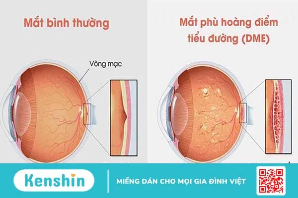 Soi đáy mắt được sử dụng để làm gì? 3