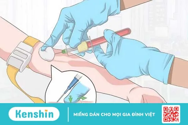 Tai biến khi tiêm tĩnh mạch là gì? Nguyên nhân và phương pháp xử lý 3