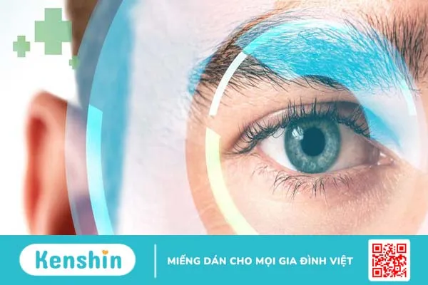 Tái cận sau mổ lasik, nguyên nhân do đâu 1