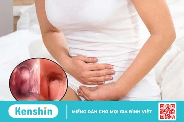 Tại sao viêm lộ tuyến cổ tử cung gây chậm kinh? 1