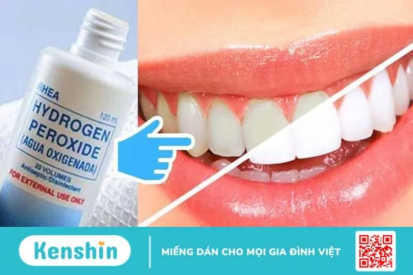 Oxy già là dung dịch sát khuẩn giúp tẩy trắng răng