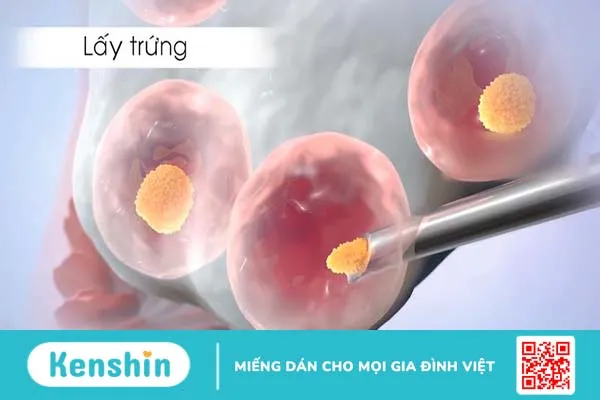 Thắc mắc: Thụ tinh ống nghiệm có an toàn không 2