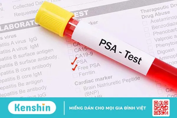 Thang điểm Gleason là gì? Những thông tin cần biết về ung thư tuyến tiền liệt 3