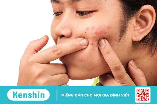 Loại mụn nào có thể nặn? Thế nào là cách nặn mụn đúng cách 1